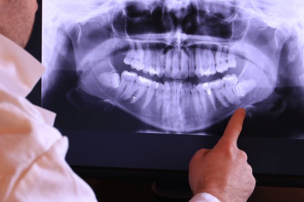 Best Root Canal Emergency Dentist  in Watsontown, PA