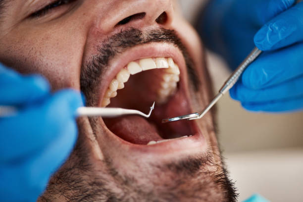 Best Chipped Tooth Repair Near Me  in Watsontown, PA